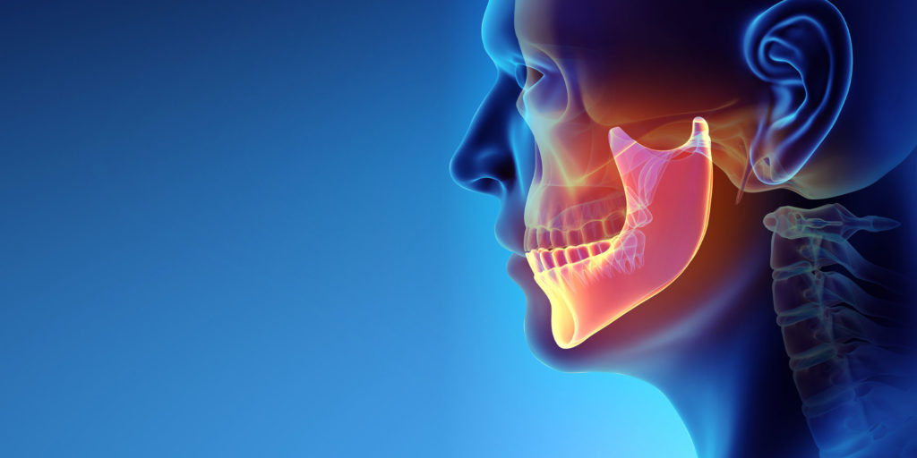3D jaw bone model
