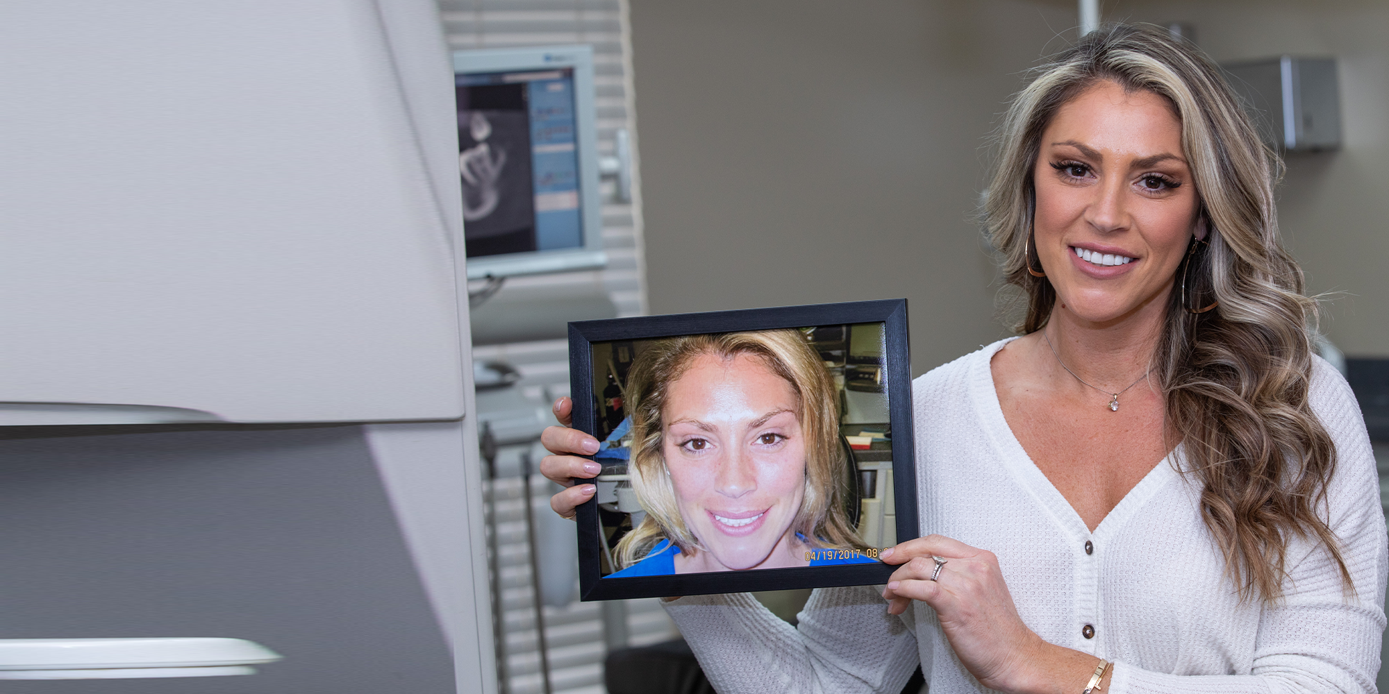 patient holding her before smile photo up