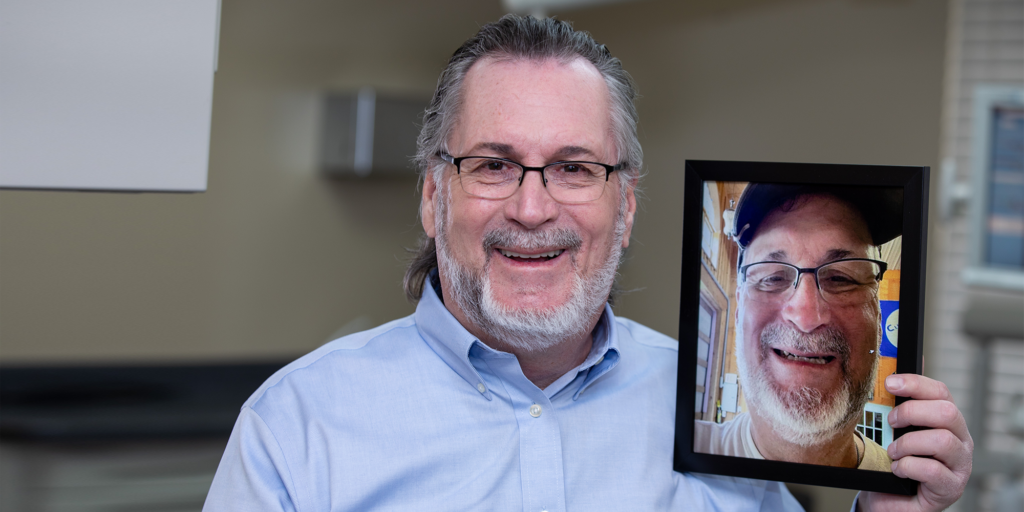 Man smiling while holding his before dental treatment photo